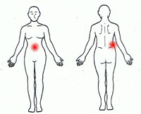 腰痛２図